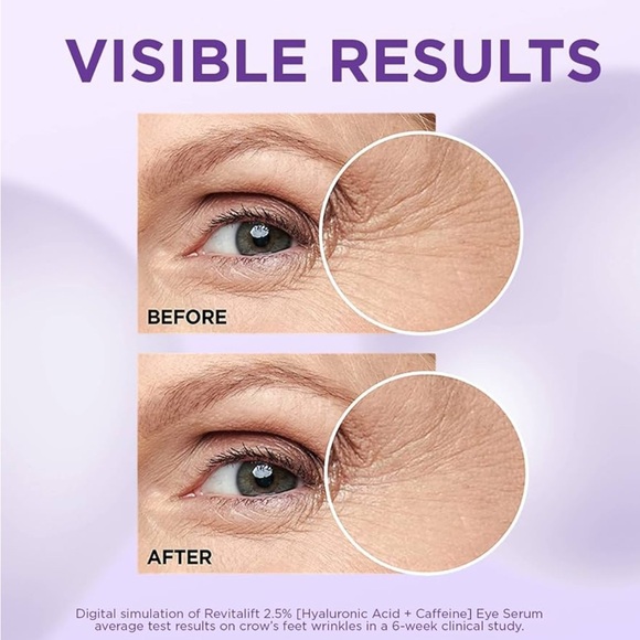 L'Oreal Revitalift Derm Intensives Brightening Eye Serum Hyaluronic & Caffeine - Picture 4 of 9